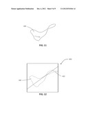 PATIENT-SPECIFIC MANUFACTURING OF POROUS METAL PROSTHESES diagram and image