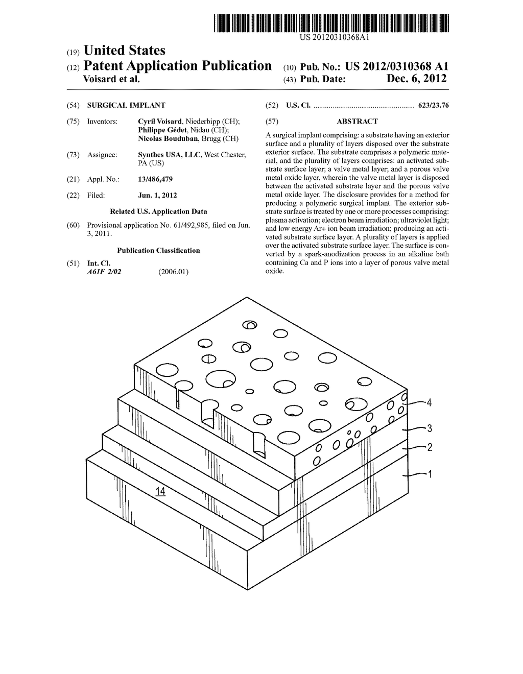 Surgical Implant - diagram, schematic, and image 01