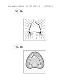 DEVELOPING PREDICTIVE DOSE-VOLUME RELATIONSHIPS FOR A RADIOTHERAPY     TREATMENT diagram and image