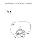 DEVELOPING PREDICTIVE DOSE-VOLUME RELATIONSHIPS FOR A RADIOTHERAPY     TREATMENT diagram and image