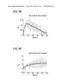 DEVELOPING PREDICTIVE DOSE-VOLUME RELATIONSHIPS FOR A RADIOTHERAPY     TREATMENT diagram and image