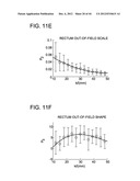 DEVELOPING PREDICTIVE DOSE-VOLUME RELATIONSHIPS FOR A RADIOTHERAPY     TREATMENT diagram and image