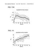 DEVELOPING PREDICTIVE DOSE-VOLUME RELATIONSHIPS FOR A RADIOTHERAPY     TREATMENT diagram and image