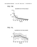 DEVELOPING PREDICTIVE DOSE-VOLUME RELATIONSHIPS FOR A RADIOTHERAPY     TREATMENT diagram and image