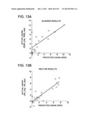 DEVELOPING PREDICTIVE DOSE-VOLUME RELATIONSHIPS FOR A RADIOTHERAPY     TREATMENT diagram and image