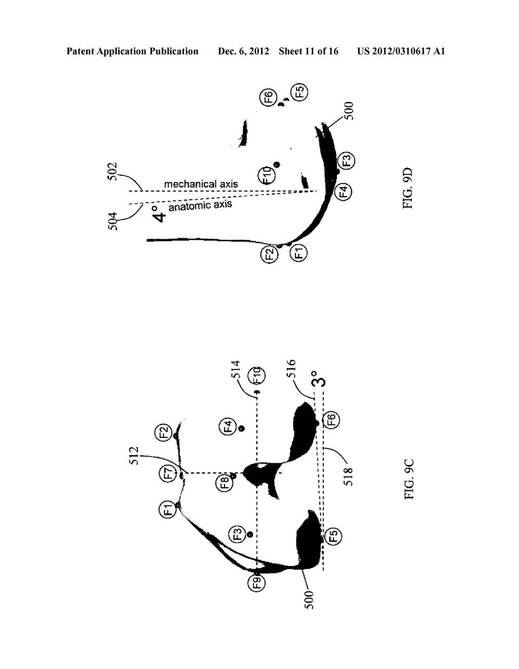 Implant Planning for Multiple Implant Components Using Constraints - diagram, schematic, and image 12