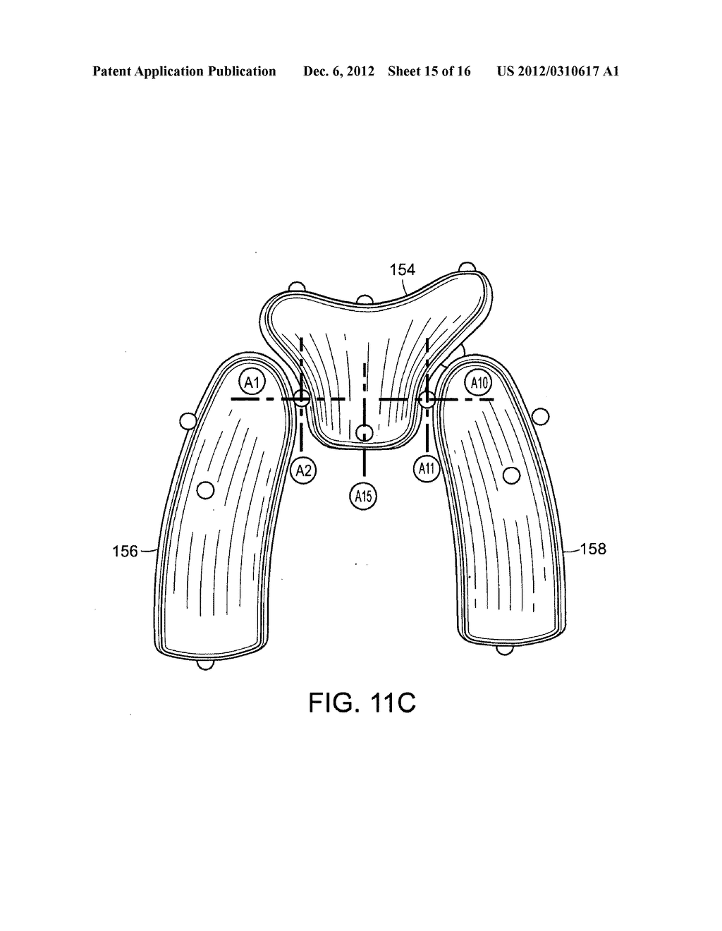 Implant Planning for Multiple Implant Components Using Constraints - diagram, schematic, and image 16