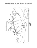 SYSTEM AND METHOD FOR PATIENT TURNING AND REPOSITIONING WITH SIMULTANEOUS     OFF-LOADING OF THE BONY PROMINENCES diagram and image