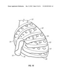 WET/DRY VACUUM APPLIANCE, DUST FILTRATION ATTACHMENT THEREFORE, AND     METHODS OF USE diagram and image