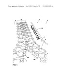  WATERPROOF ZIPPER AND MANUFACTURING METHOD THEREFOR diagram and image