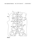  WATERPROOF ZIPPER AND MANUFACTURING METHOD THEREFOR diagram and image