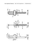 Water Softener System and Method diagram and image