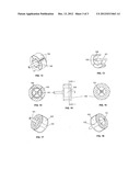 ROTOR OR STATOR EMBEDMENT diagram and image