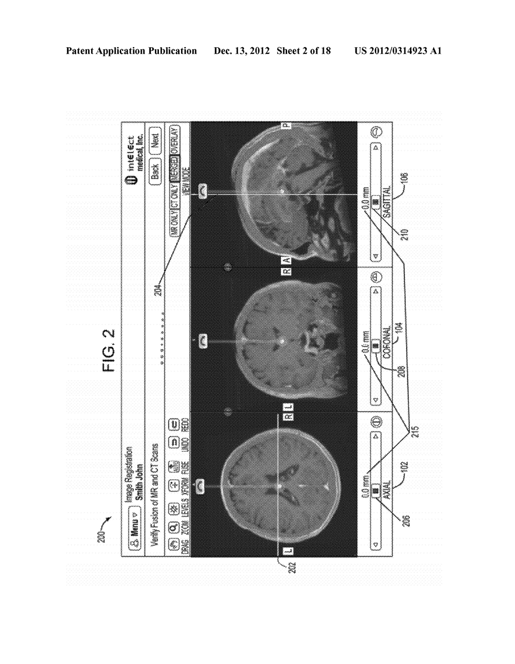 SYSTEM AND METHOD FOR IMAGE REGISTRATION - diagram, schematic, and image 03