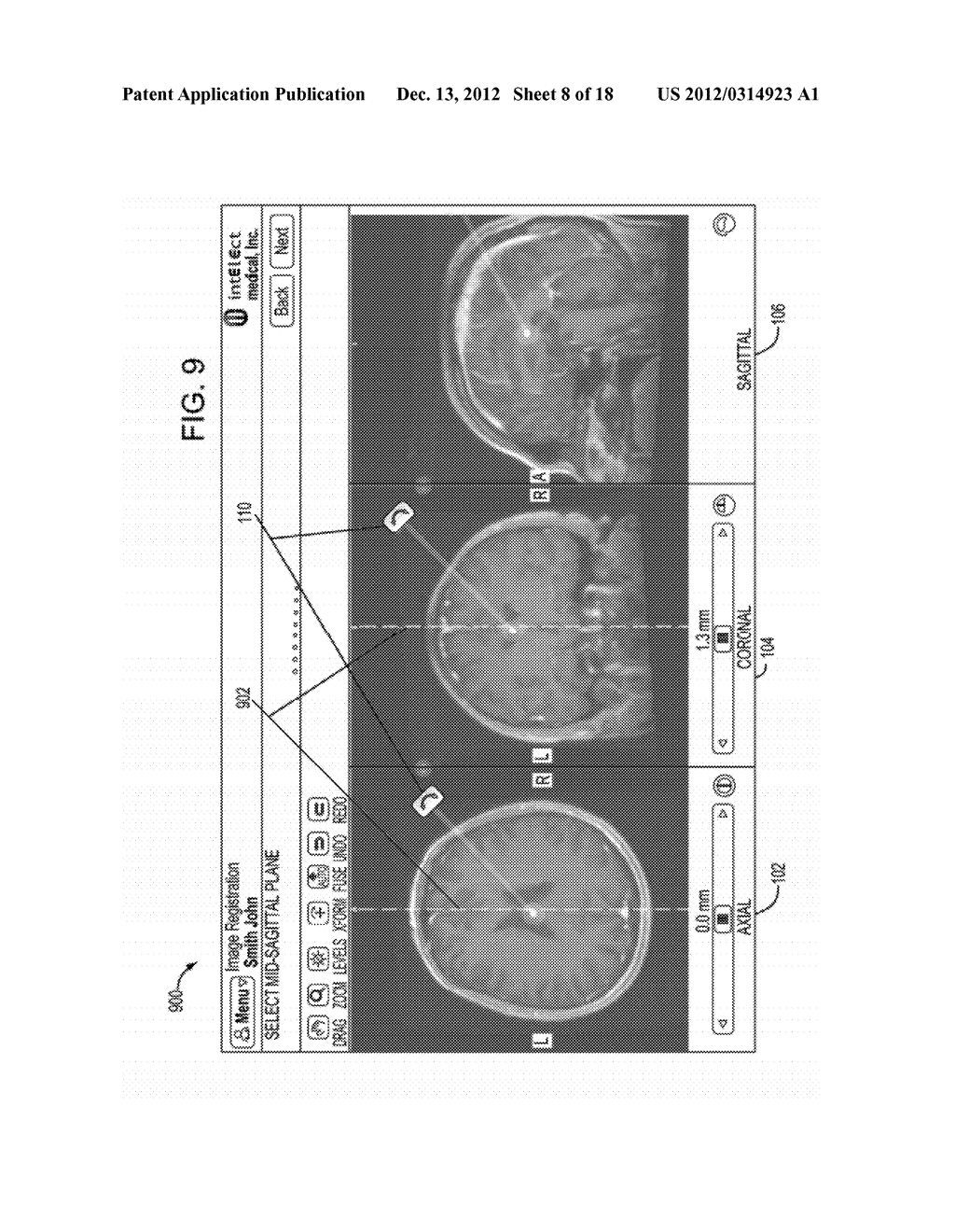 SYSTEM AND METHOD FOR IMAGE REGISTRATION - diagram, schematic, and image 09