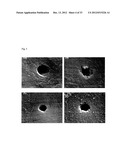 Anti-Bacterial and Mineralizing Calcium Phosphate Compositions diagram and image