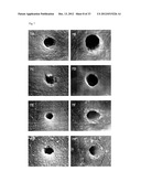 Anti-Bacterial and Mineralizing Calcium Phosphate Compositions diagram and image