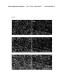 Anti-Bacterial and Mineralizing Calcium Phosphate Compositions diagram and image