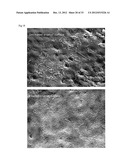 Anti-Bacterial and Mineralizing Calcium Phosphate Compositions diagram and image