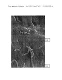 Anti-Bacterial and Mineralizing Calcium Phosphate Compositions diagram and image