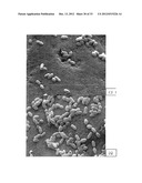 Anti-Bacterial and Mineralizing Calcium Phosphate Compositions diagram and image