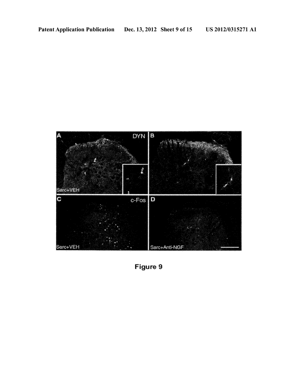 METHODS FOR TREATING BONE CANCER BY ADMINISTERING A NERVE GROWTH FACTOR     ANTAGONIST ANTIBODY - diagram, schematic, and image 10