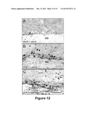 METHODS FOR TREATING BONE CANCER BY ADMINISTERING A NERVE GROWTH FACTOR     ANTAGONIST ANTIBODY diagram and image