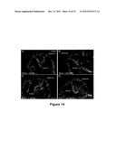 METHODS FOR TREATING BONE CANCER BY ADMINISTERING A NERVE GROWTH FACTOR     ANTAGONIST ANTIBODY diagram and image