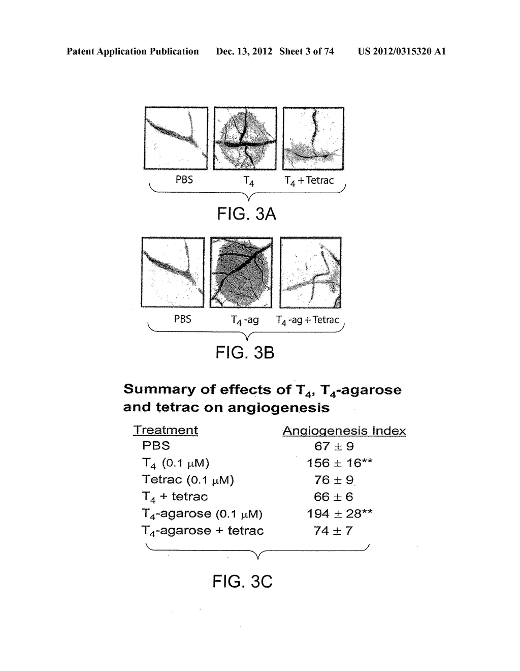 USES OF FORMULATIONS OF THYROID HORMONE ANALOGS AND NANOPARTICULATE FORMS     THEREOF TO INCREASE CHEMOSENSIVITY AND RADIOSENSITIVITY IN TUMOR OR     CANCER CELLS - diagram, schematic, and image 04