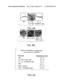 USES OF FORMULATIONS OF THYROID HORMONE ANALOGS AND NANOPARTICULATE FORMS     THEREOF TO INCREASE CHEMOSENSIVITY AND RADIOSENSITIVITY IN TUMOR OR     CANCER CELLS diagram and image