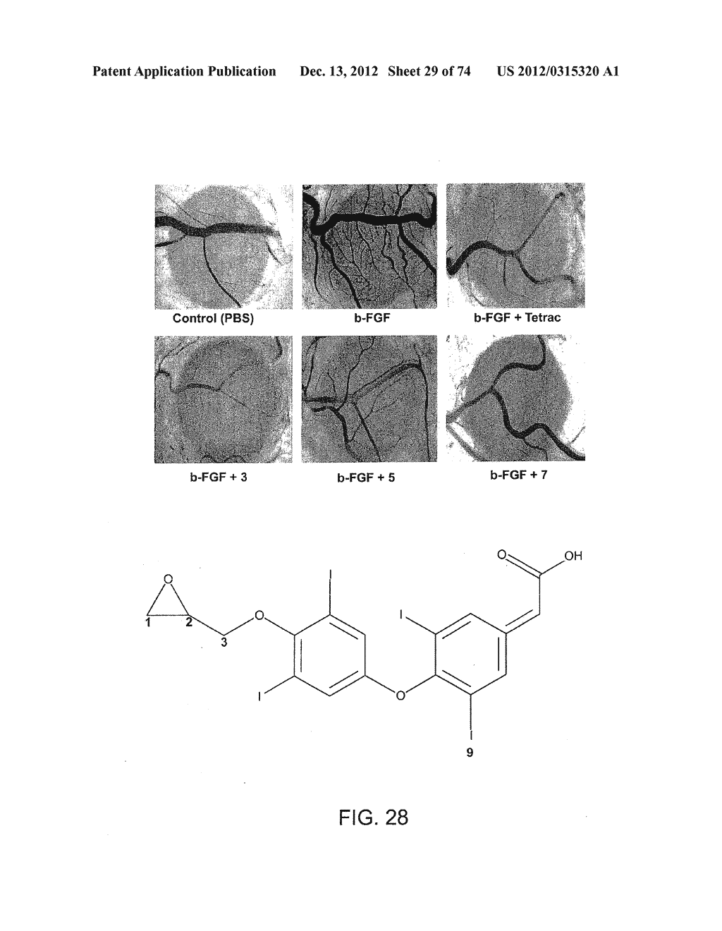 USES OF FORMULATIONS OF THYROID HORMONE ANALOGS AND NANOPARTICULATE FORMS     THEREOF TO INCREASE CHEMOSENSIVITY AND RADIOSENSITIVITY IN TUMOR OR     CANCER CELLS - diagram, schematic, and image 30