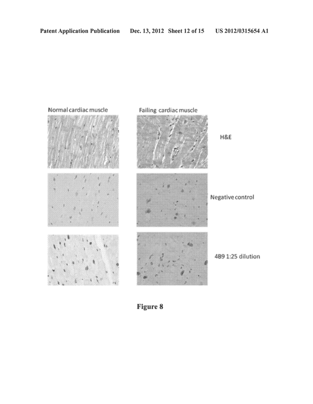 COMPOSITIONS AND METHODS FOR DETECTING CARDIOTOXICITY - diagram, schematic, and image 13