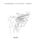 SYSTEM AND METHOD FOR PROCESSING SLAUGHTERED ANIMALS AND/OR PARTS THEREOF diagram and image