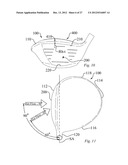 GOLF CLUB HEAD HAVING TRIP STEP FEATURE diagram and image