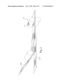 Method and Apparatus for Making Absorbent Structures with Absorbent     Material diagram and image