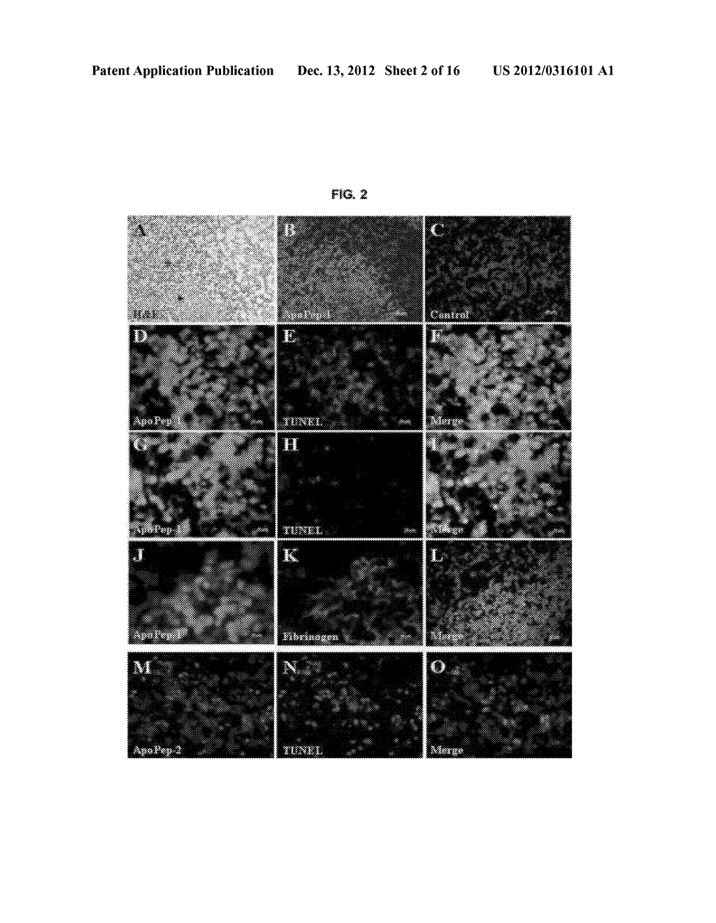 PEPTIDES FOR TARGETING APOPTOTIC CELLS AND USES THEREOF - diagram, schematic, and image 03