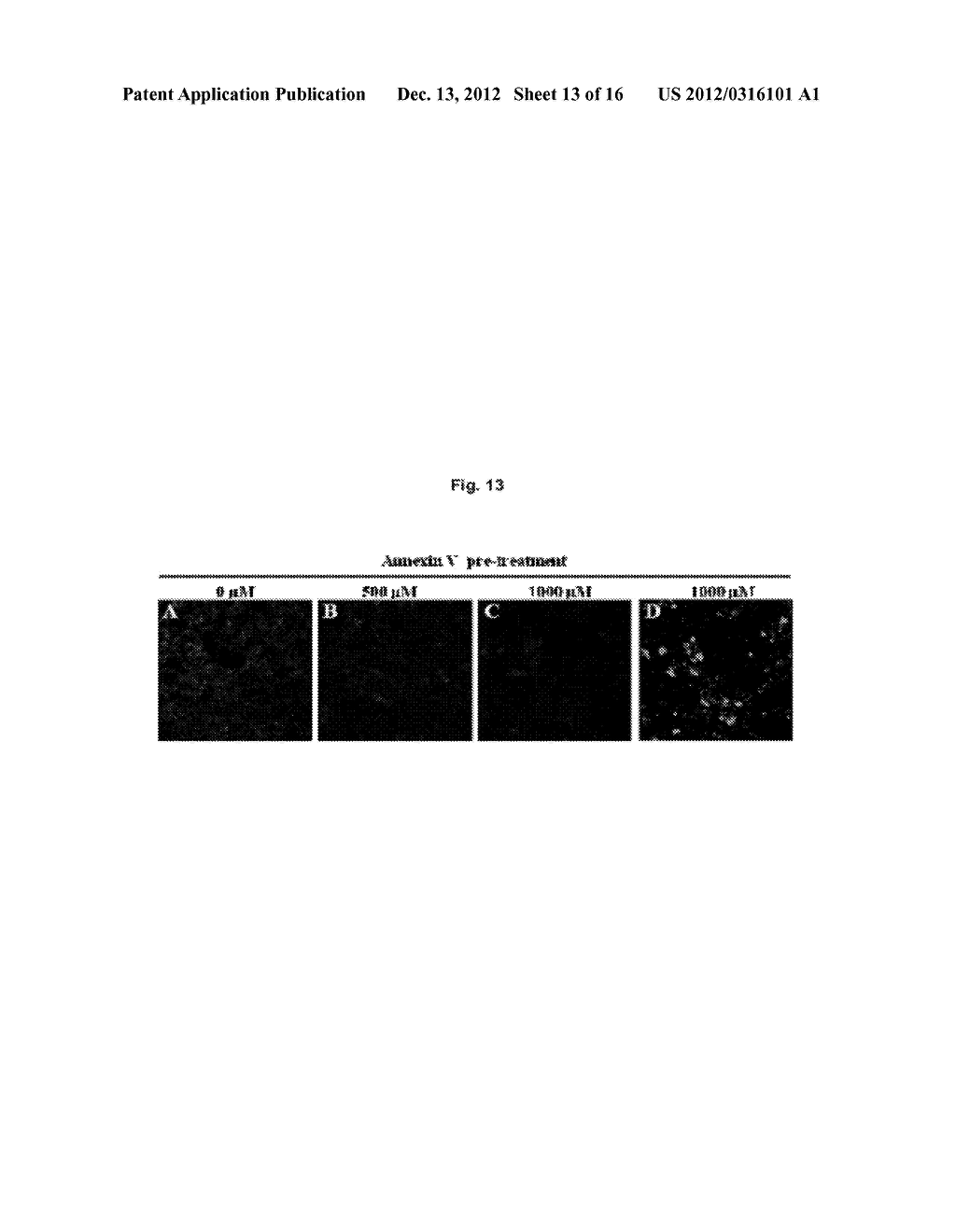 PEPTIDES FOR TARGETING APOPTOTIC CELLS AND USES THEREOF - diagram, schematic, and image 14