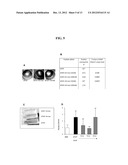 METHODS AND COMPOSITIONS FOR INHIBITING ANGIOGENESIS diagram and image