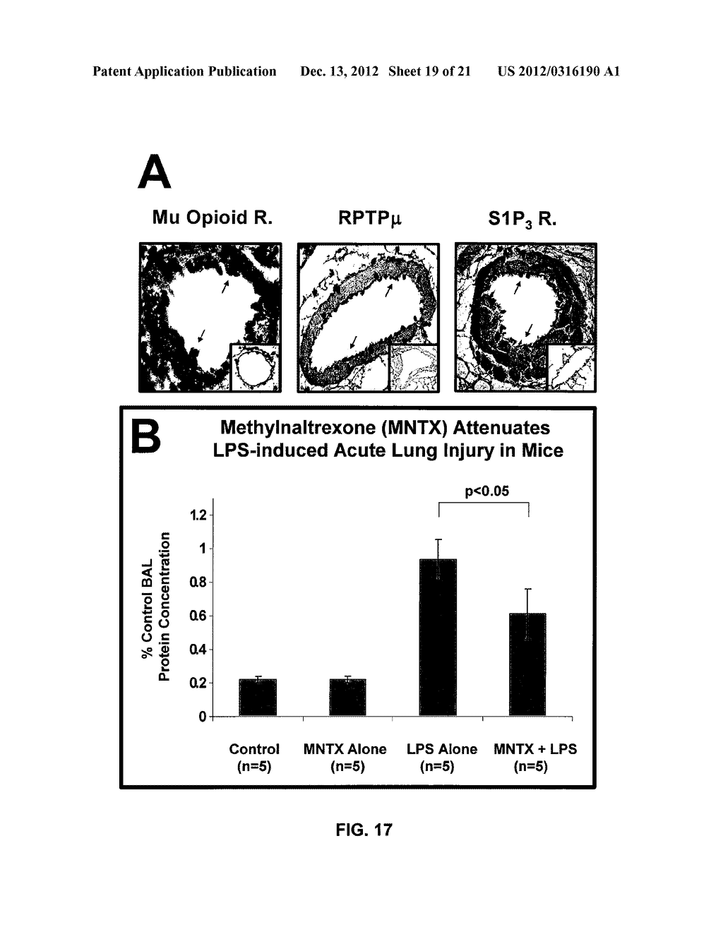 Modulation of Cell Barrier Dysfunction - diagram, schematic, and image 20