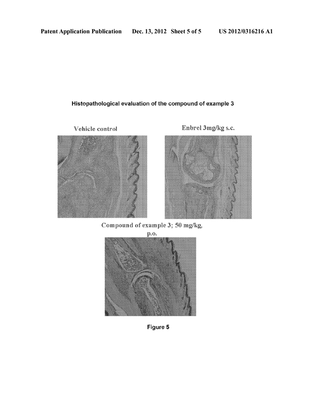 PYRROLIDINE SUBSTITUTE FLAVONES FOR THE TREATMENT OF INFLAMMATORY     DISORDERS - diagram, schematic, and image 06