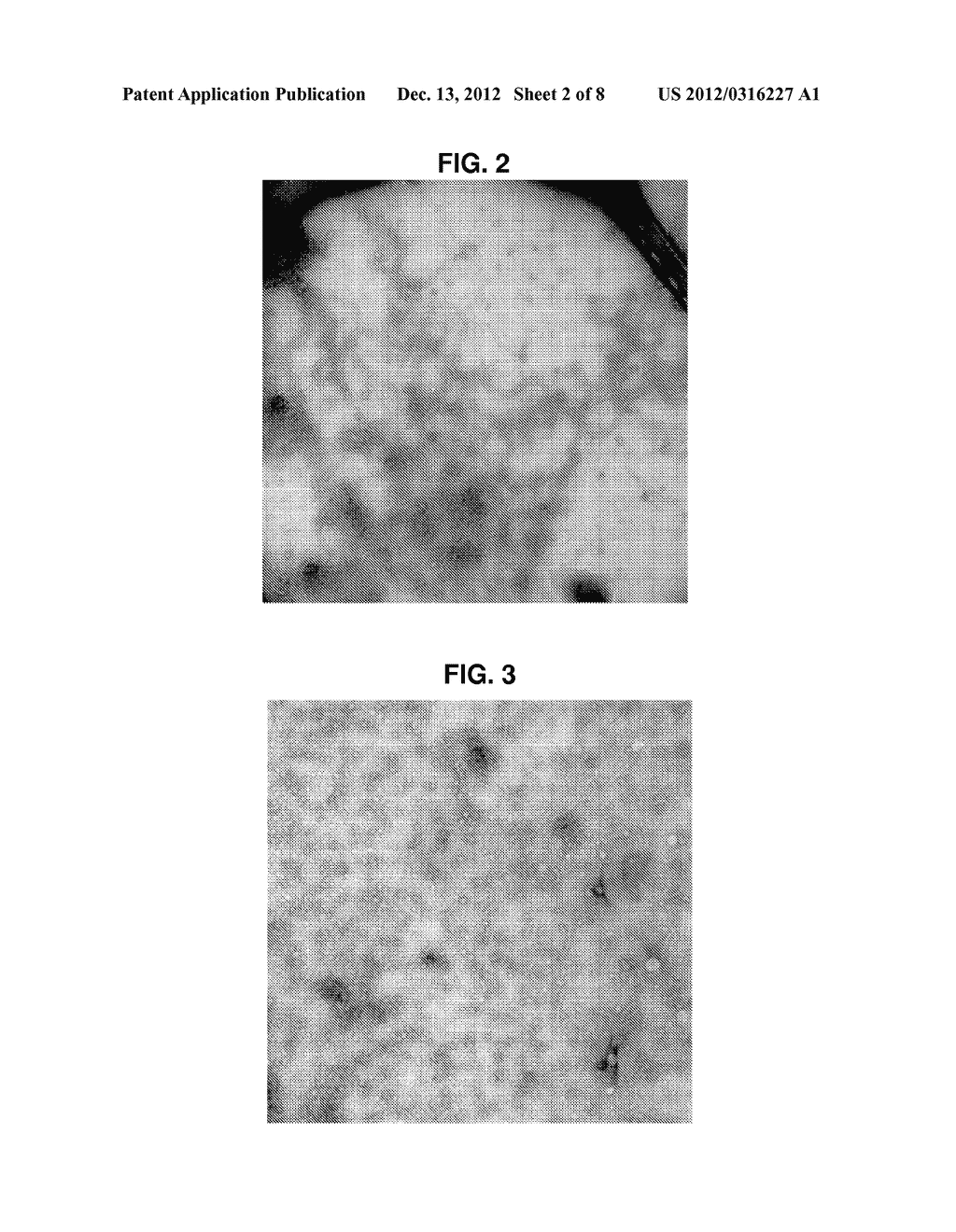 CHRYSOPHAENTIN ANTIMICROBIAL COMPOUNDS THAT INHIBIT FTSZ PROTEIN - diagram, schematic, and image 03