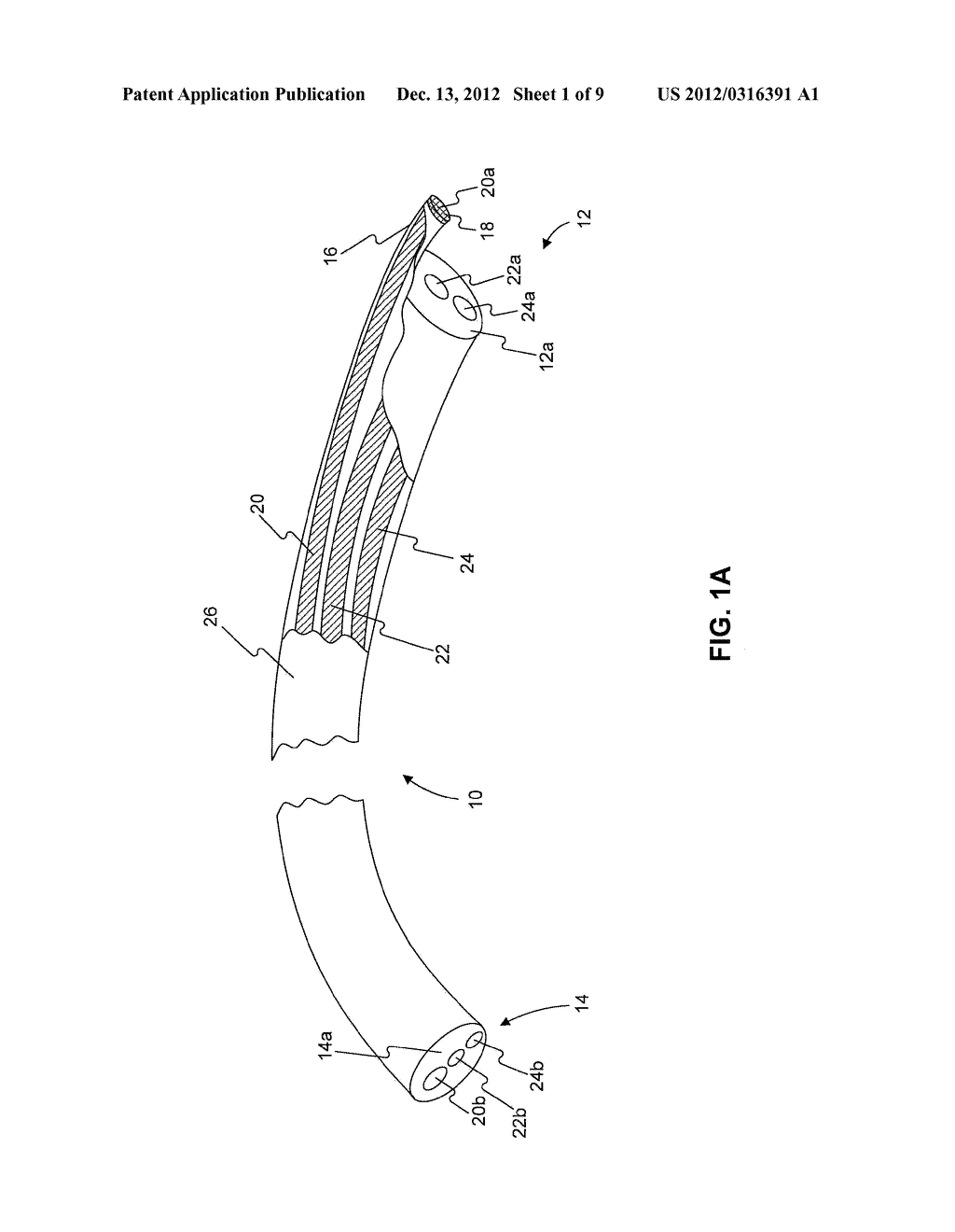 DISPOSABLE SHEATH - diagram, schematic, and image 02