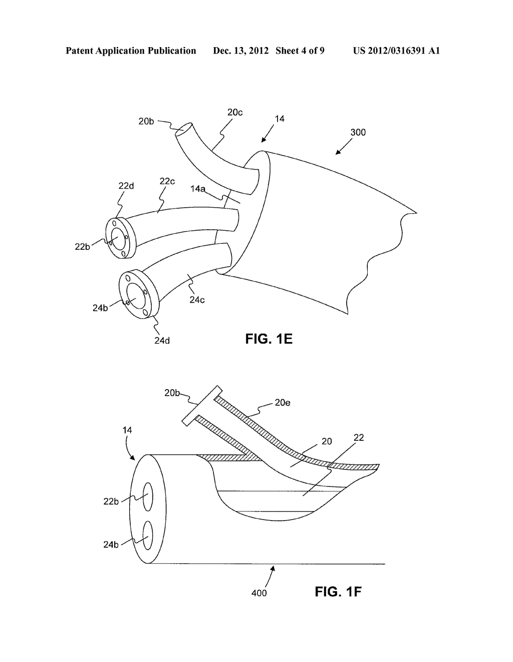 DISPOSABLE SHEATH - diagram, schematic, and image 05