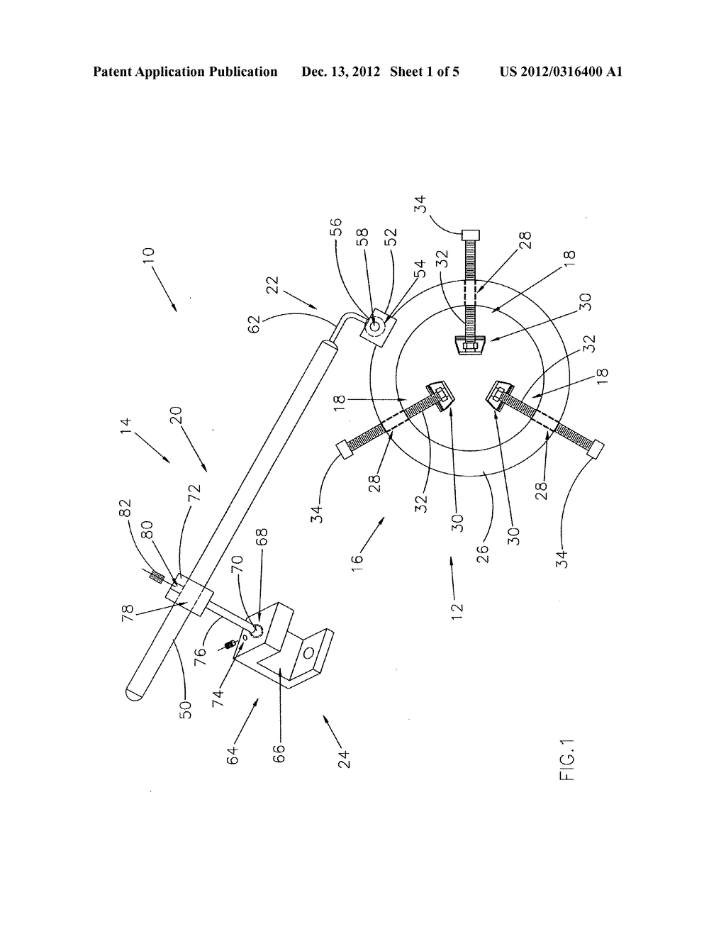 Surgical tissue retractor - diagram, schematic, and image 02