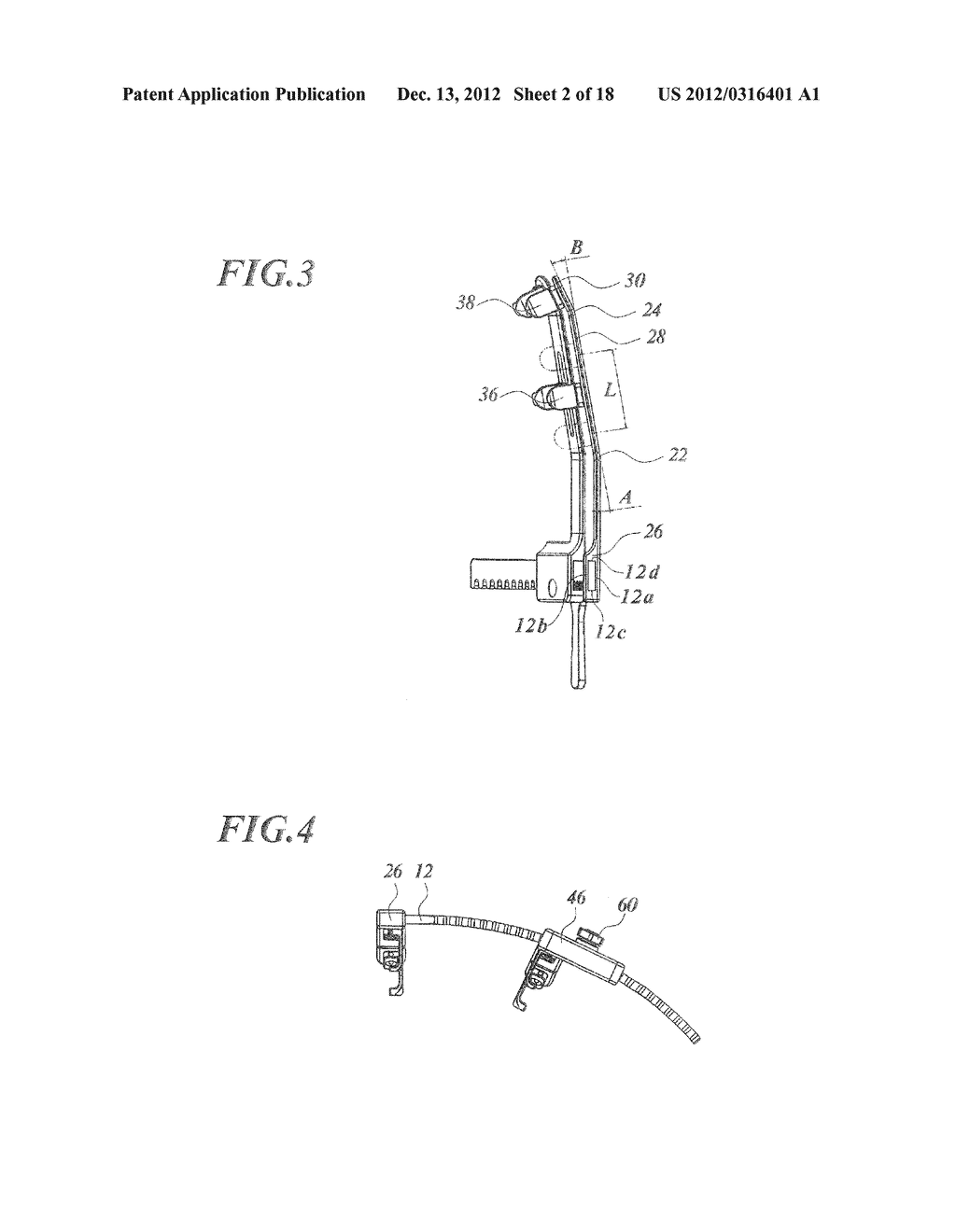 RIB SPREADER - diagram, schematic, and image 03