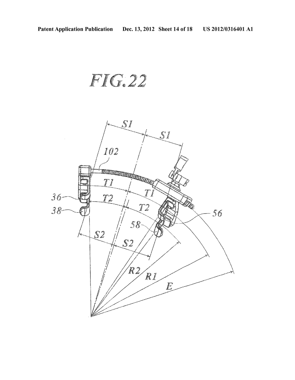 RIB SPREADER - diagram, schematic, and image 15