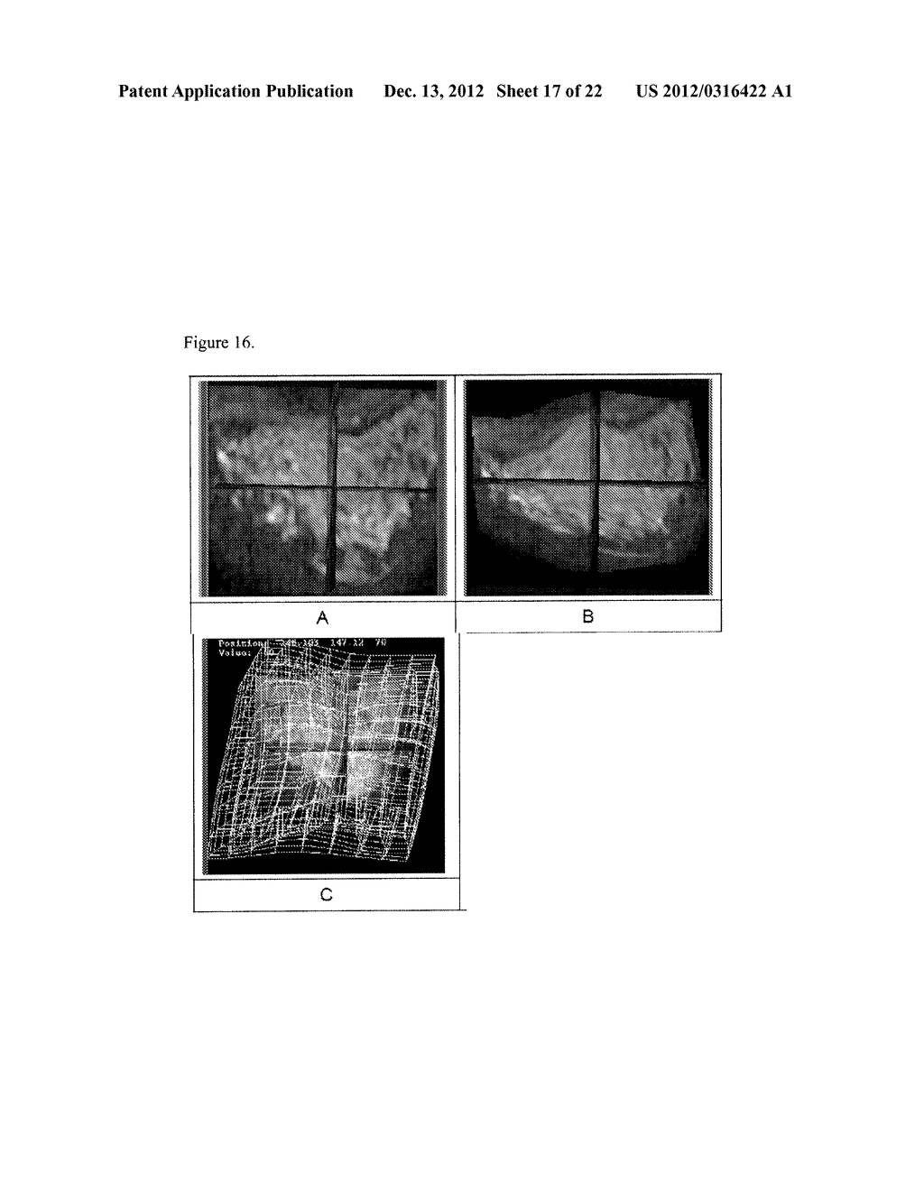 Systems and Methods for Tissue Imaging - diagram, schematic, and image 18