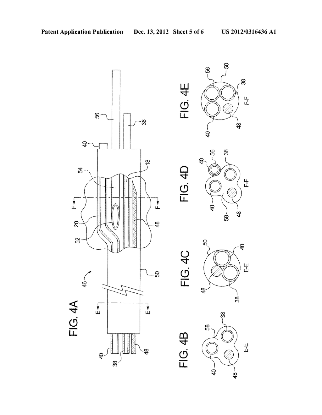 BALLOON CATHETER WITH THREE LUMENS - diagram, schematic, and image 06