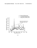 RAMAN SPECTRAL ANALYSIS FOR DISEASE DETECTION AND MONITORING diagram and image