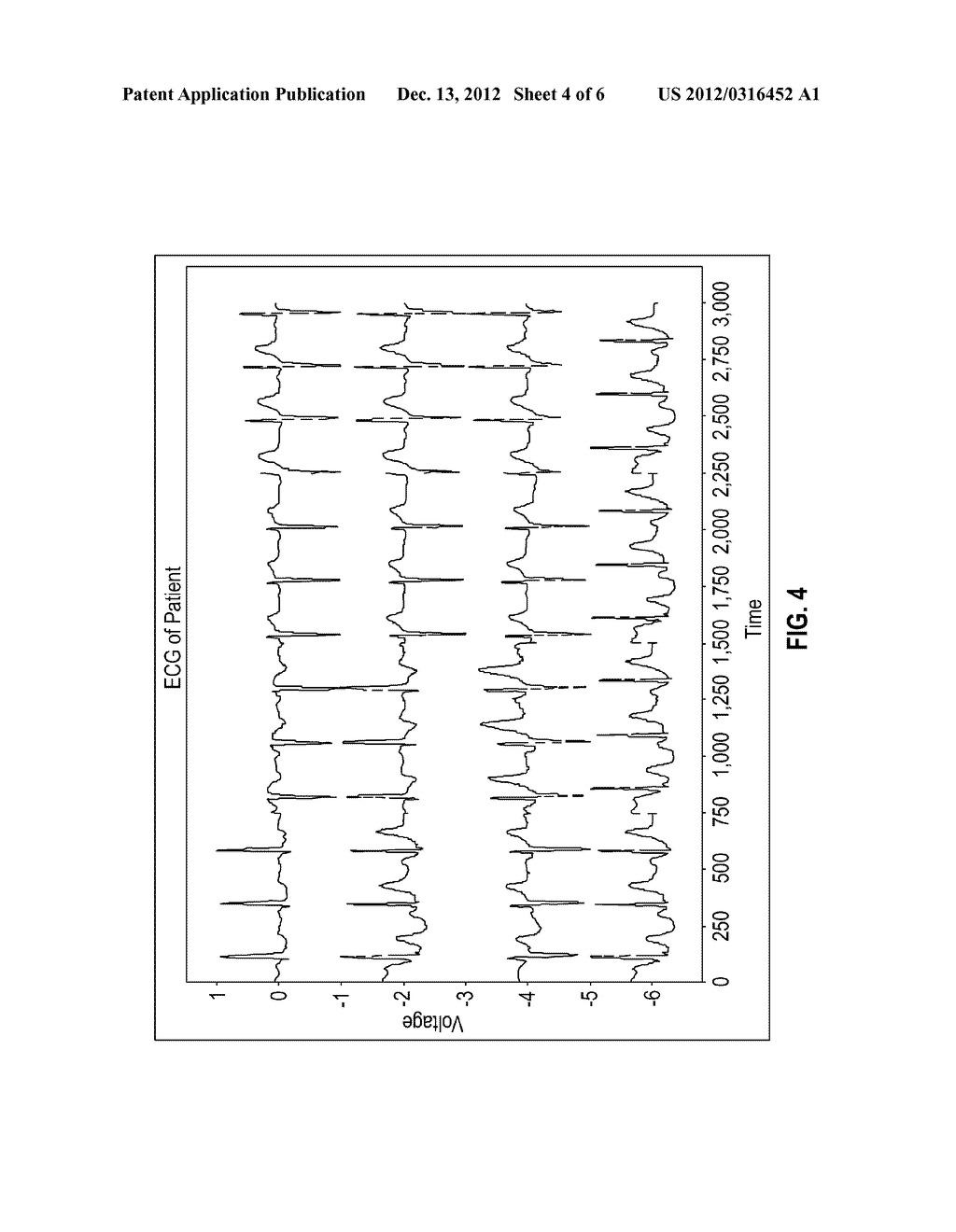 METHOD FOR DETERMINING A HEART PERIOD FROM AN ECG WAVEFORM USING IMAGE     REPRESENTATION OF ECG - diagram, schematic, and image 05